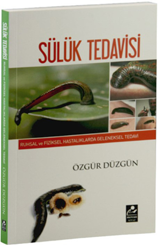 Geleneksel Sülük Tedavisi