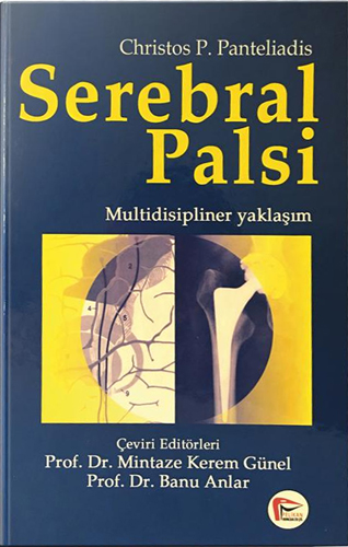 Serebral Palsi